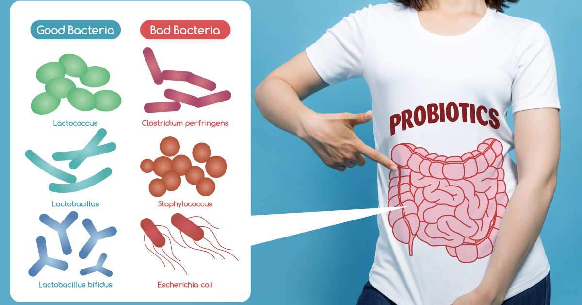 A special mention for probiotics